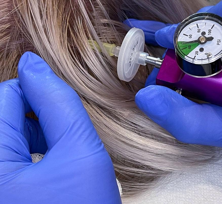 Karboksyterapia skóry głowy na porost włosów Białystok