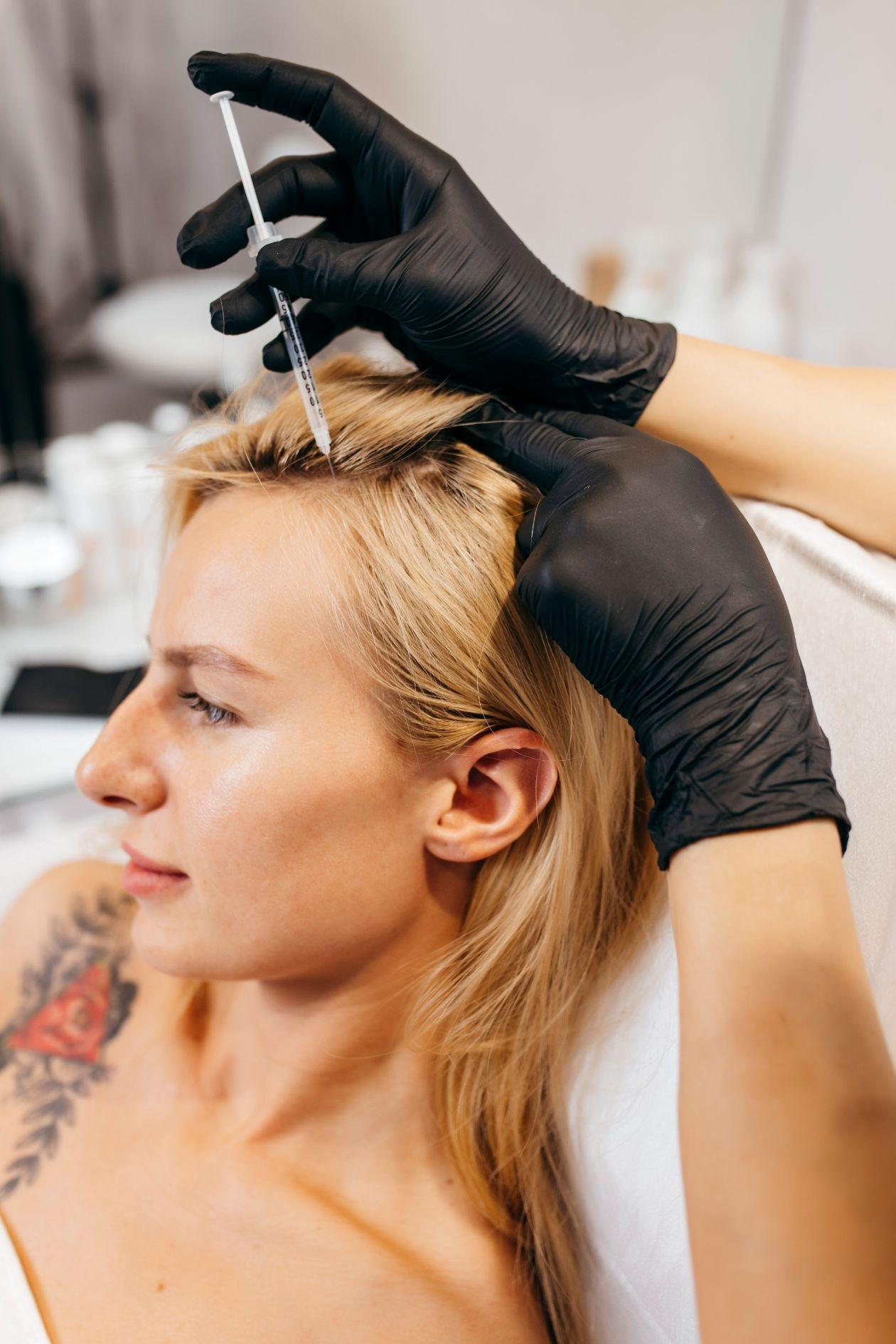 Mezoterapia igłowa skóry głowy Białystock